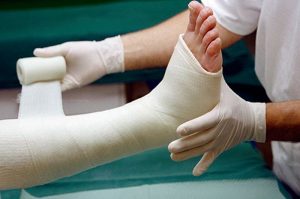 fisioterapi patah tulang