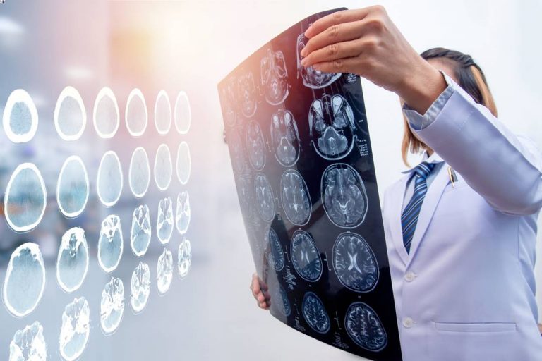 Perbedaan Stroke Hemoragik dan Nonhemoragik