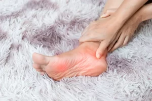 Plantar Fasciitis: Penyebab, Gejala, dan Cara Mengobatinya