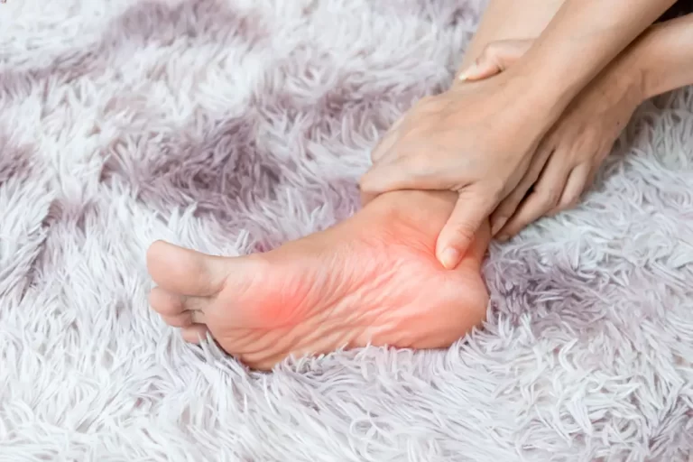 Plantar Fasciitis: Penyebab, Gejala, dan Cara Mengobatinya